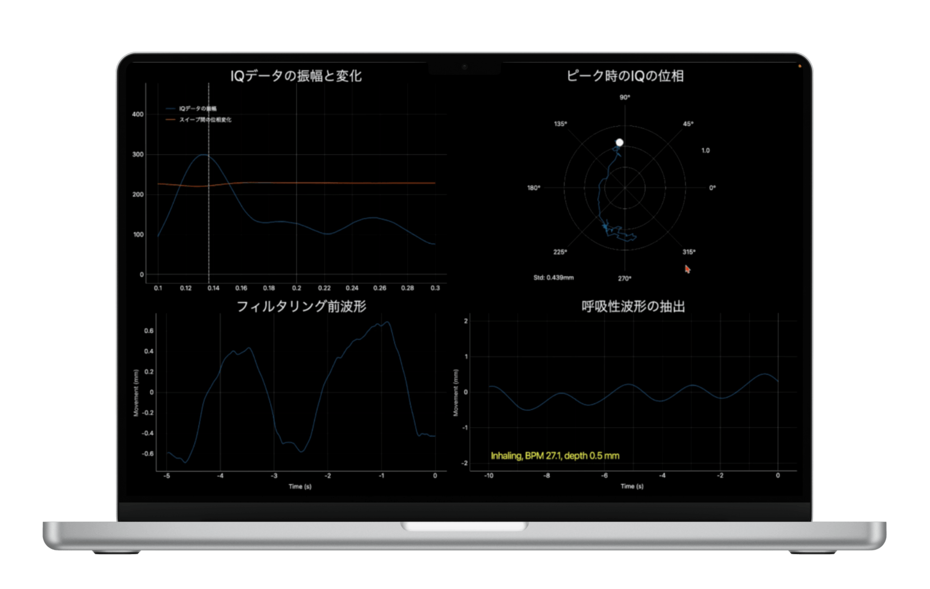 ミリ波レーダー呼吸分析